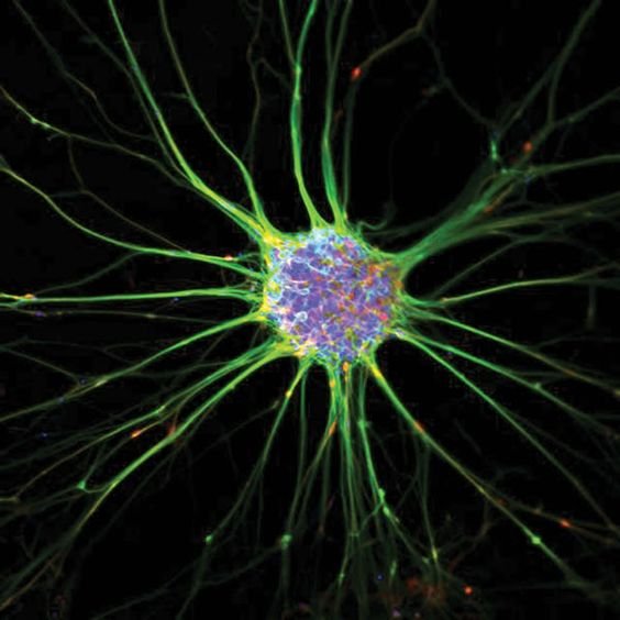 Sharona Even-Ram, Cluster of neurons differentiated from embryonic stem cells